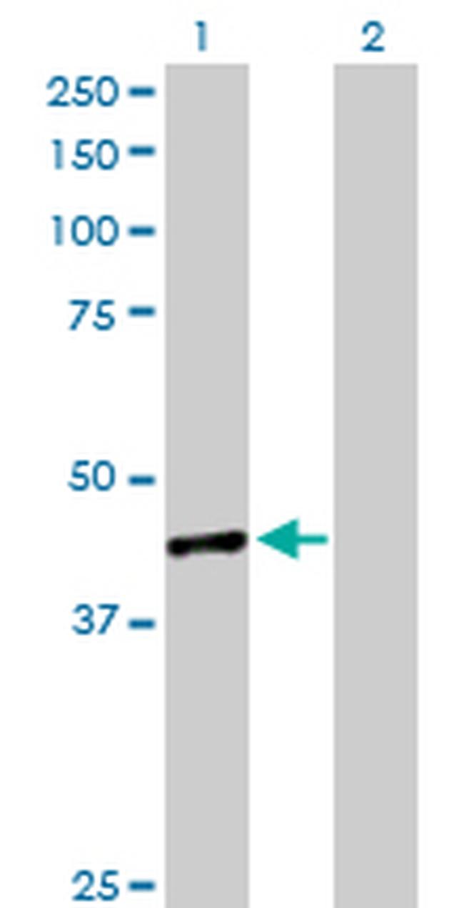 TWF1 Antibody in Western Blot (WB)