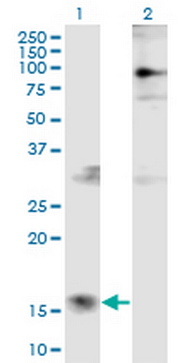 PTMS Antibody in Western Blot (WB)