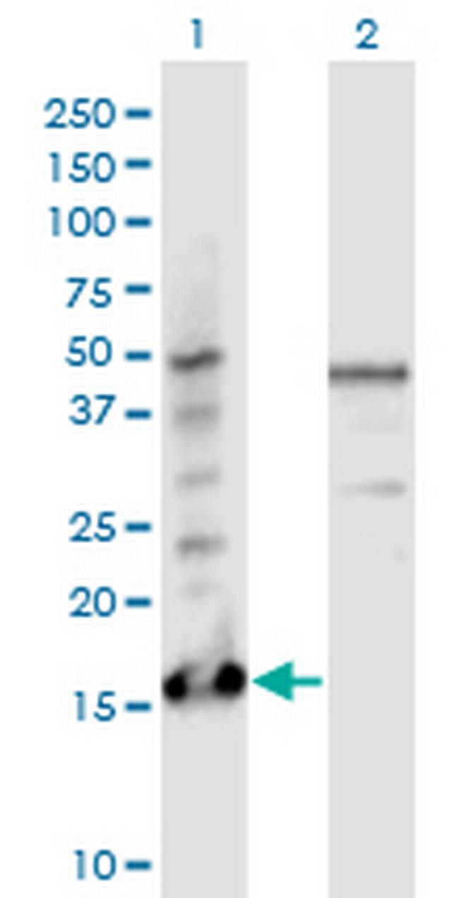 PTMS Antibody in Western Blot (WB)