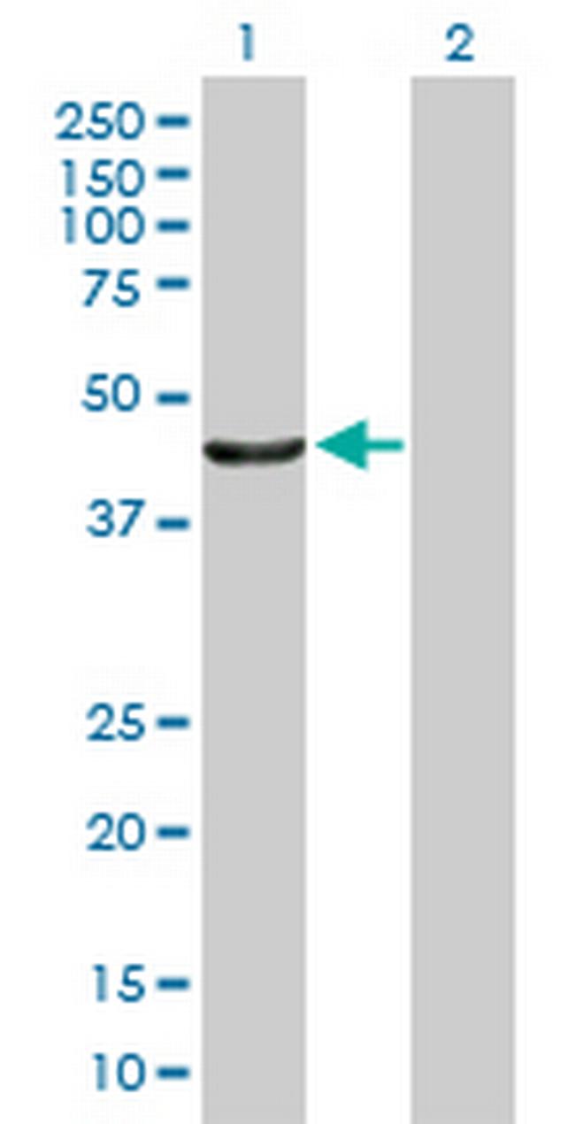 PTPN2 Antibody in Western Blot (WB)