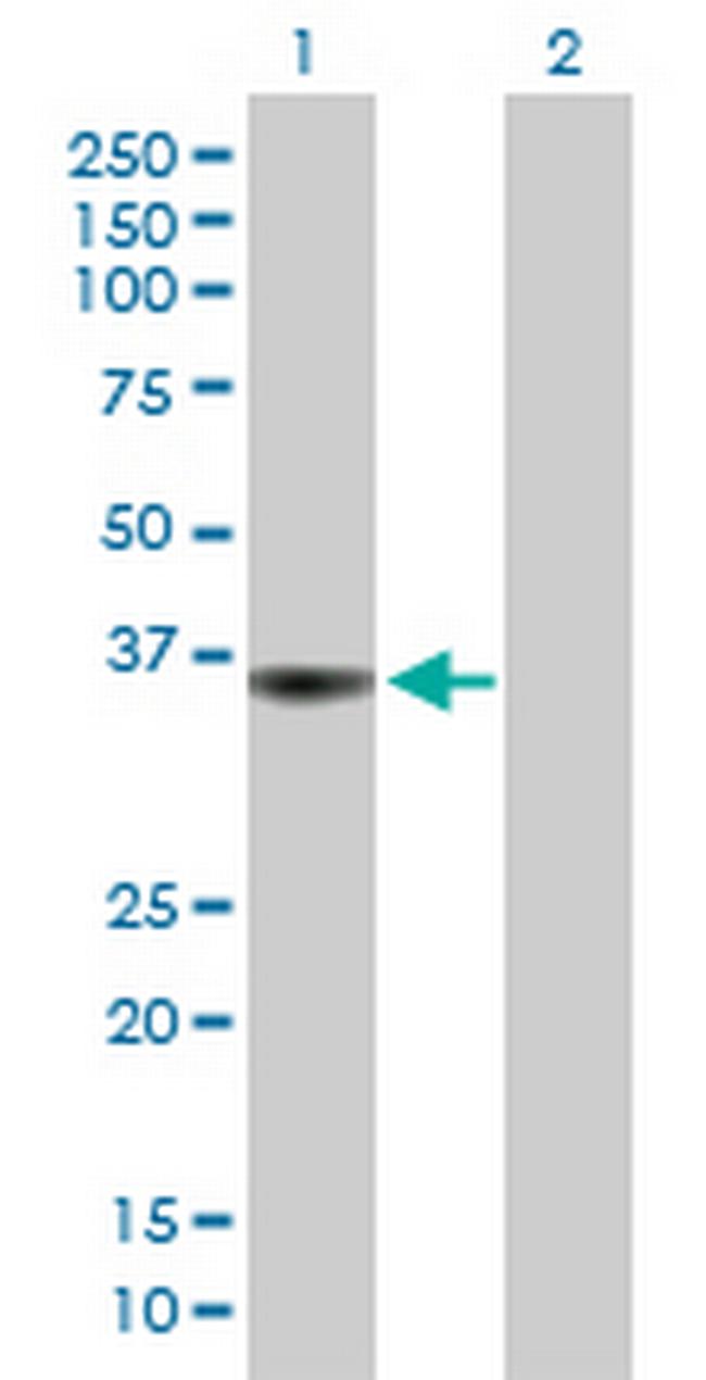 PTPRF Antibody in Western Blot (WB)
