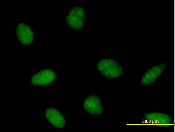 PTS Antibody in Immunocytochemistry (ICC/IF)