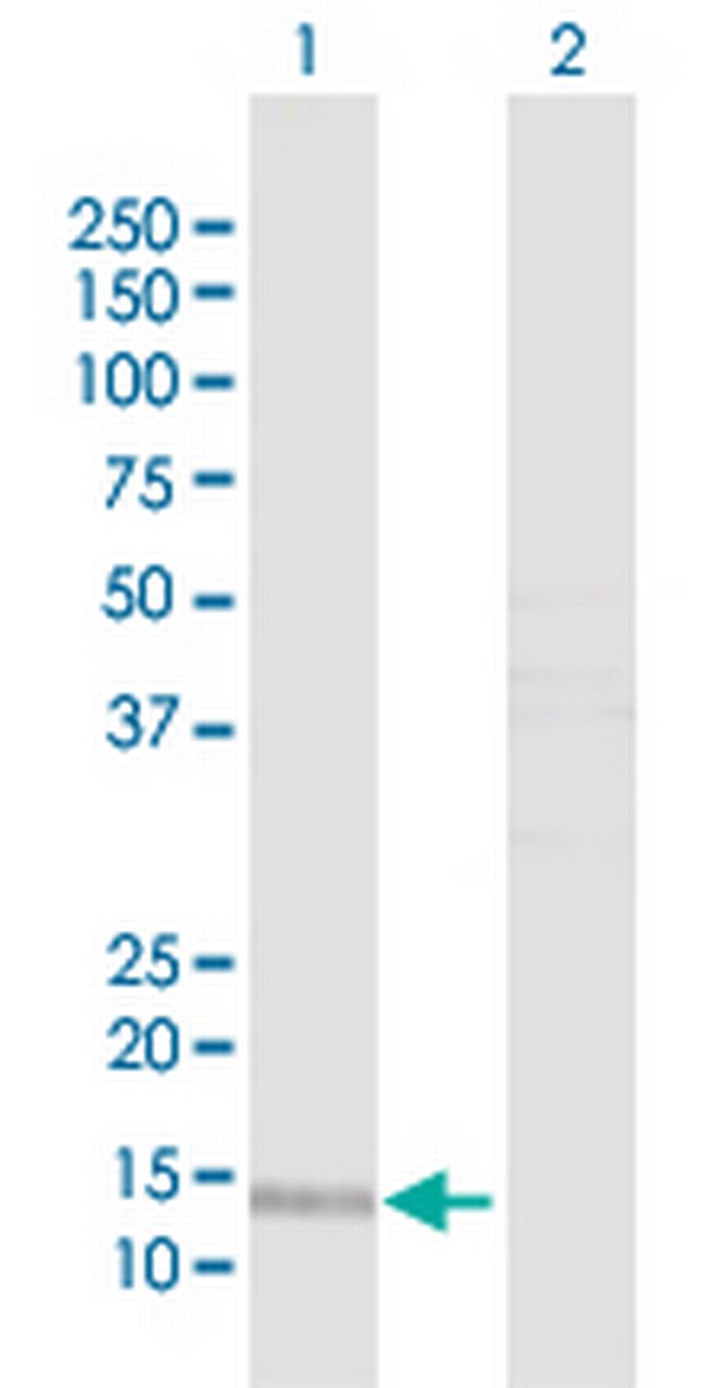 PTS Antibody in Western Blot (WB)