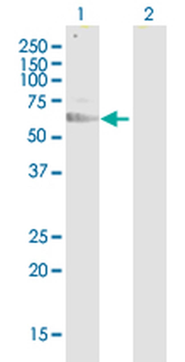 PVR Antibody in Western Blot (WB)