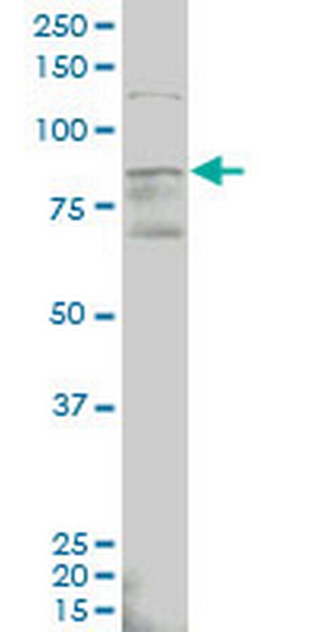 ALDH18A1 Antibody in Western Blot (WB)