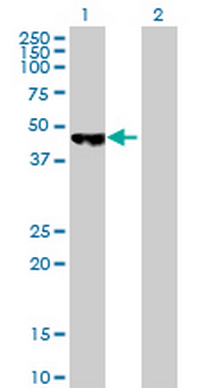 PCYT2 Antibody in Western Blot (WB)