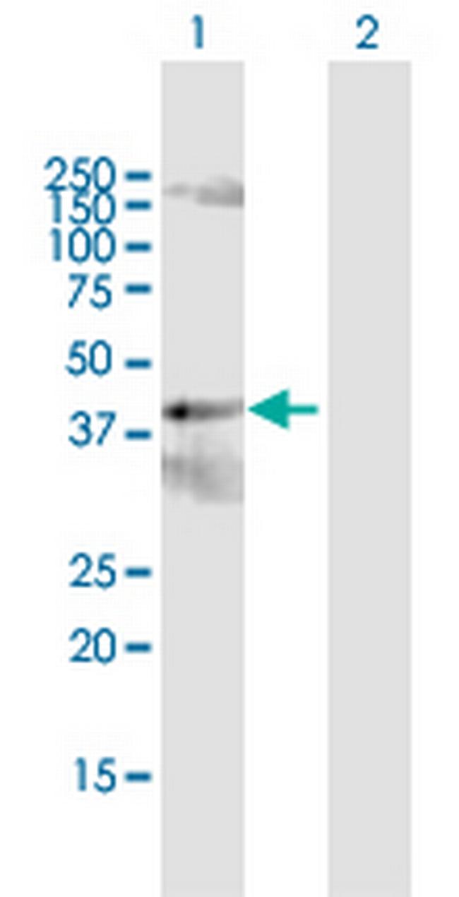 PCYT2 Antibody in Western Blot (WB)