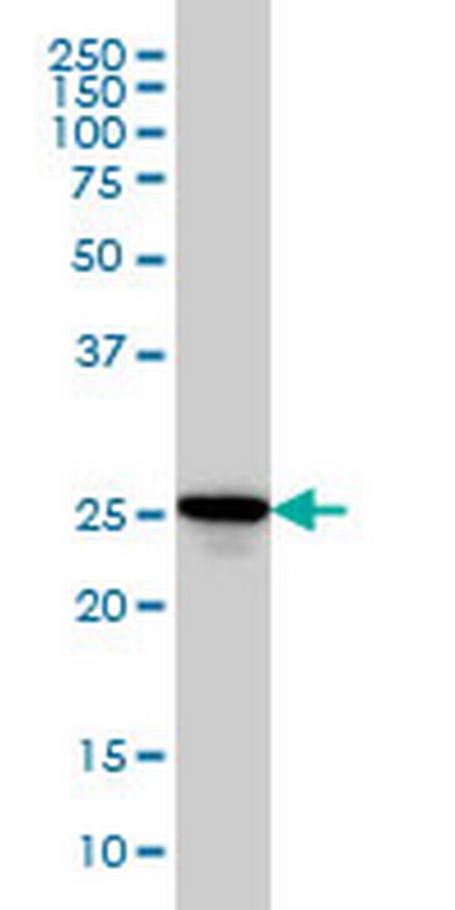 RAB27A Antibody in Western Blot (WB)