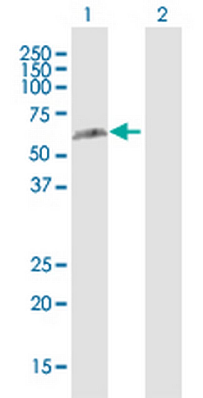 RAD23B Antibody in Western Blot (WB)