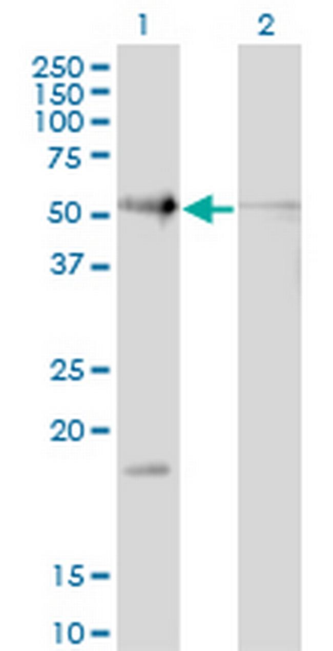 RAD23B Antibody in Western Blot (WB)