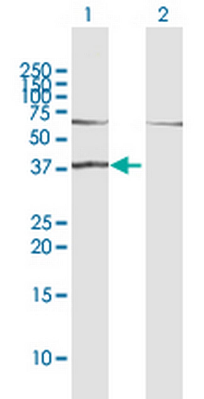 RAD51L1 Antibody in Western Blot (WB)