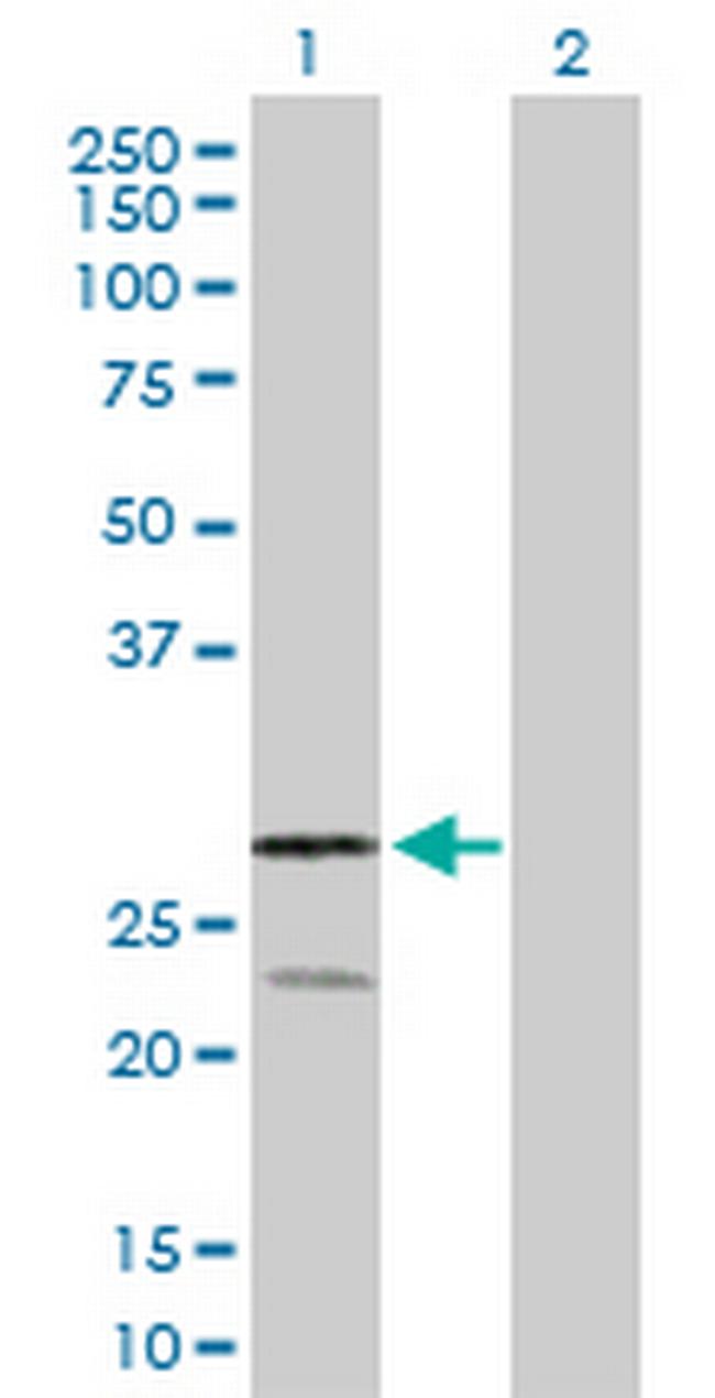 RAGE Antibody in Western Blot (WB)