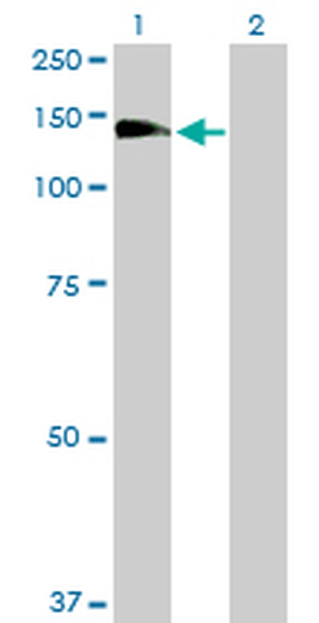 RALGDS Antibody in Western Blot (WB)