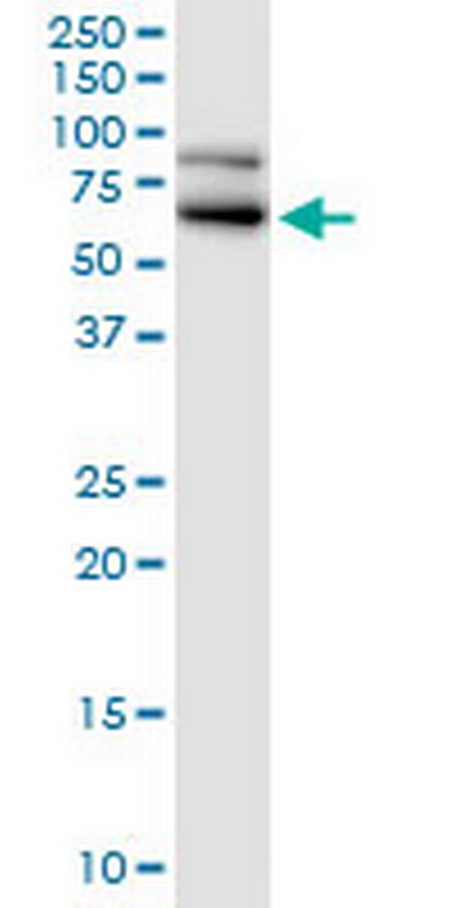 RANGAP1 Antibody in Western Blot (WB)