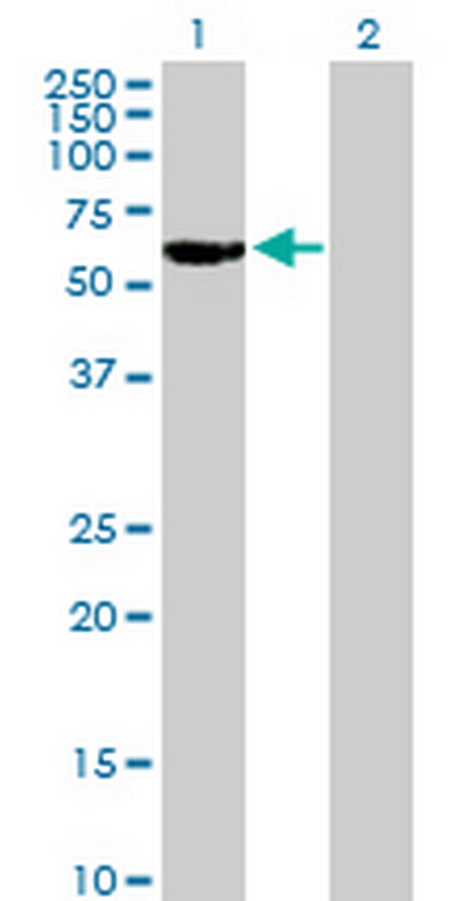RARG Antibody in Western Blot (WB)