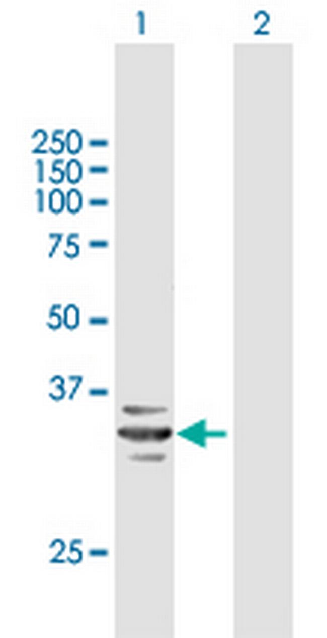 RARRES1 Antibody in Western Blot (WB)
