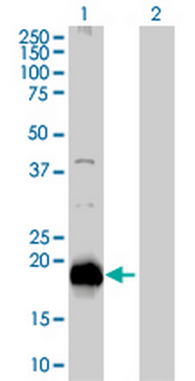 RARRES3 Antibody in Western Blot (WB)