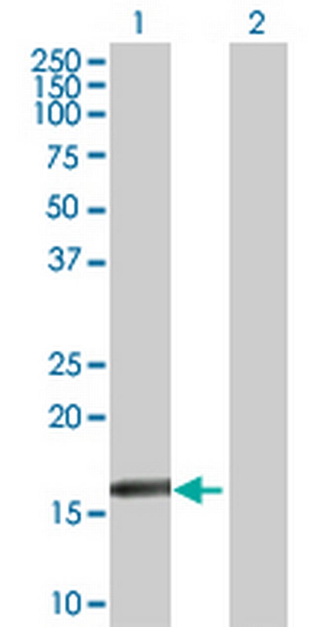 RARRES3 Antibody in Western Blot (WB)