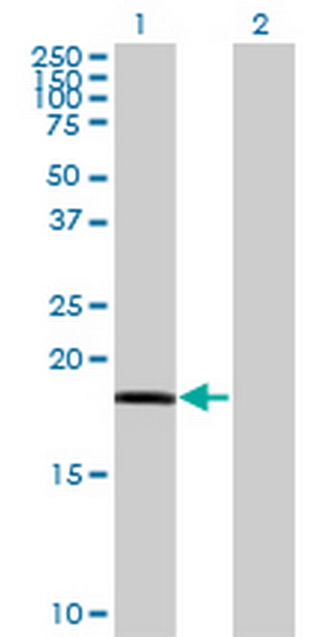 RARRES3 Antibody in Western Blot (WB)