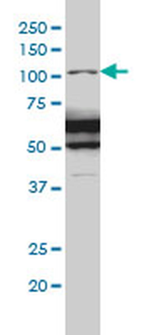 RASA1 Antibody in Western Blot (WB)
