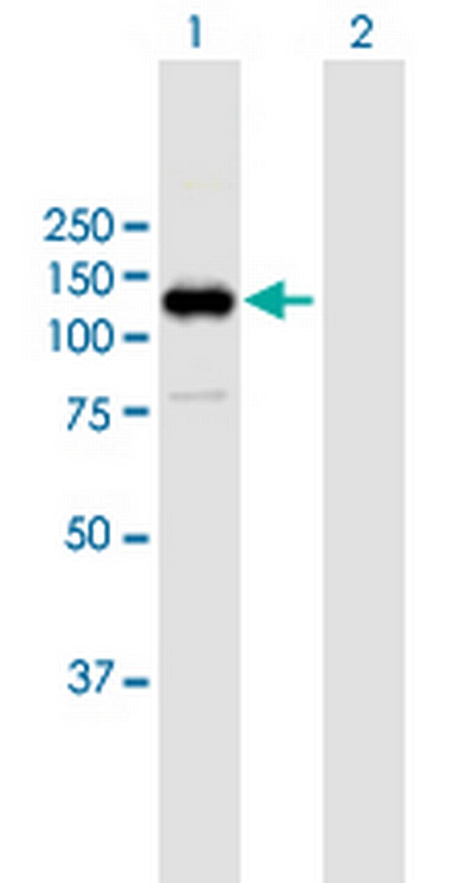 RB1 Antibody in Western Blot (WB)