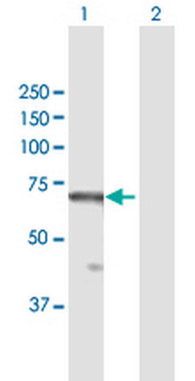 RBBP5 Antibody in Western Blot (WB)