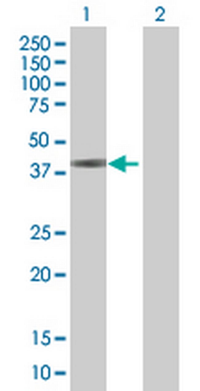 RBMS2 Antibody in Western Blot (WB)