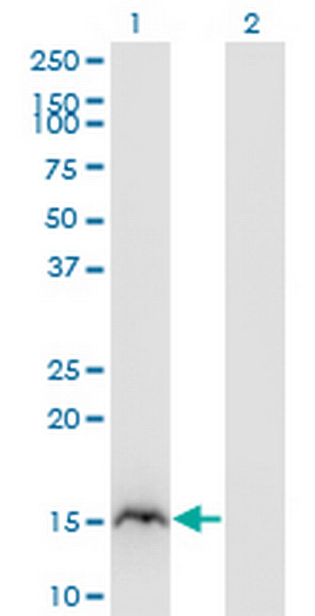 RBP2 Antibody in Western Blot (WB)
