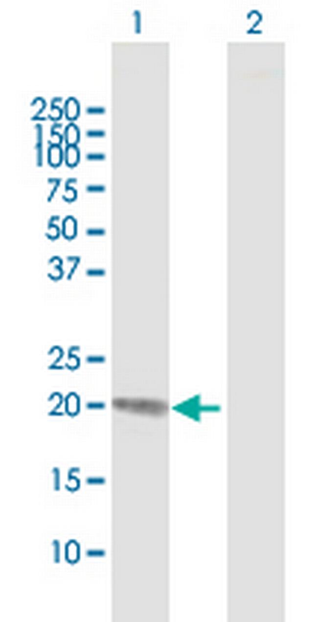 RBP4 Antibody in Western Blot (WB)
