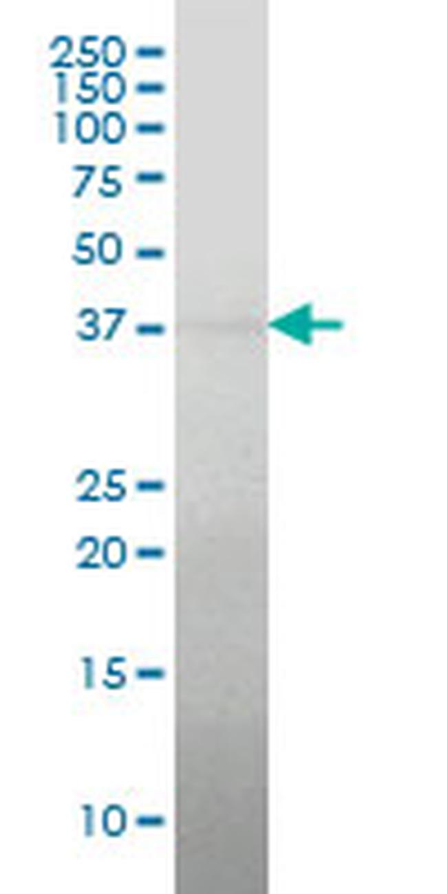 RCN2 Antibody in Western Blot (WB)