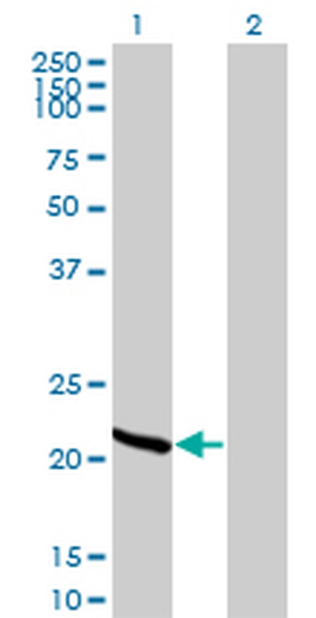 RCV1 Antibody in Western Blot (WB)