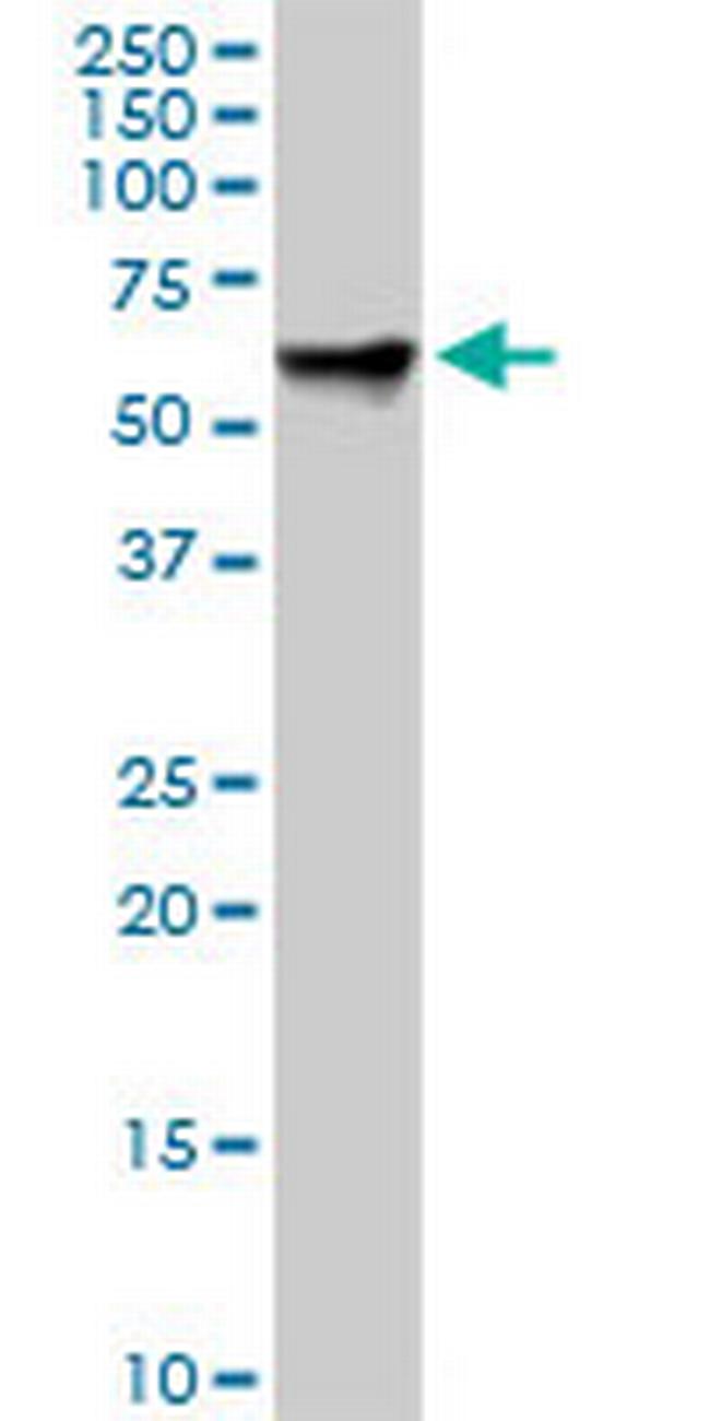 RDX Antibody in Western Blot (WB)