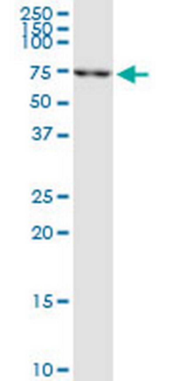 RECQL Antibody in Western Blot (WB)