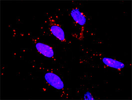 RET Antibody in Proximity Ligation Assay (PLA) (PLA)