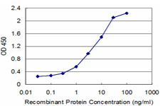 RFC1 Antibody in ELISA (ELISA)