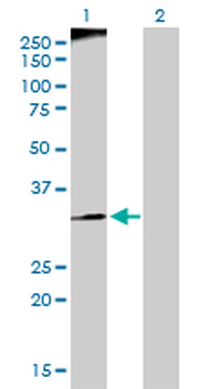 RFC3 Antibody in Western Blot (WB)