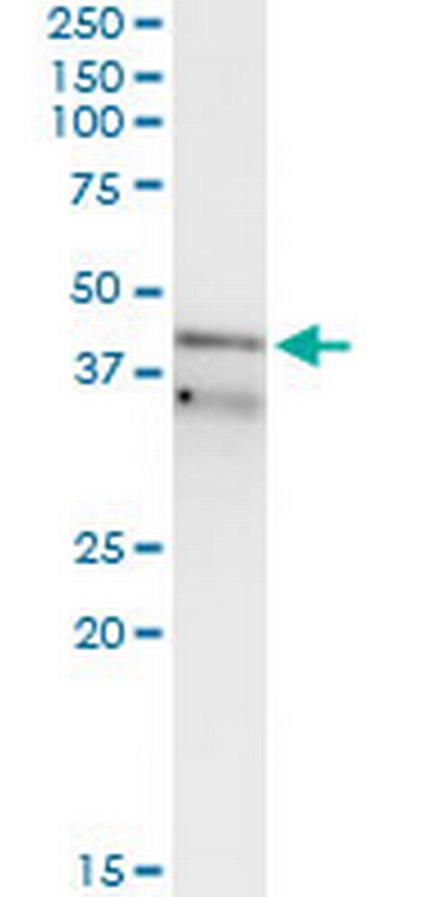 RFC3 Antibody in Immunoprecipitation (IP)