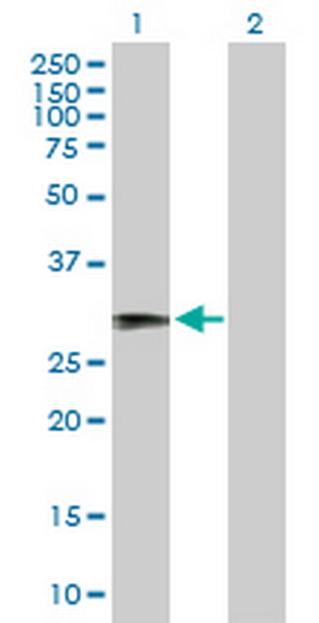RFPL1 Antibody in Western Blot (WB)