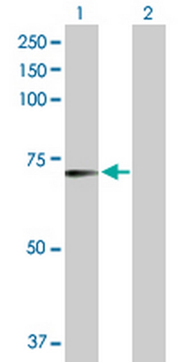 RFX5 Antibody in Western Blot (WB)