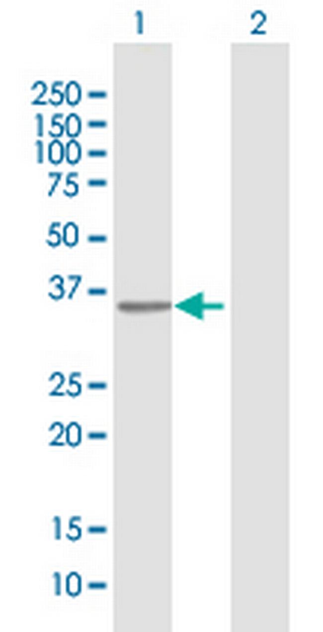 RFXAP Antibody in Western Blot (WB)