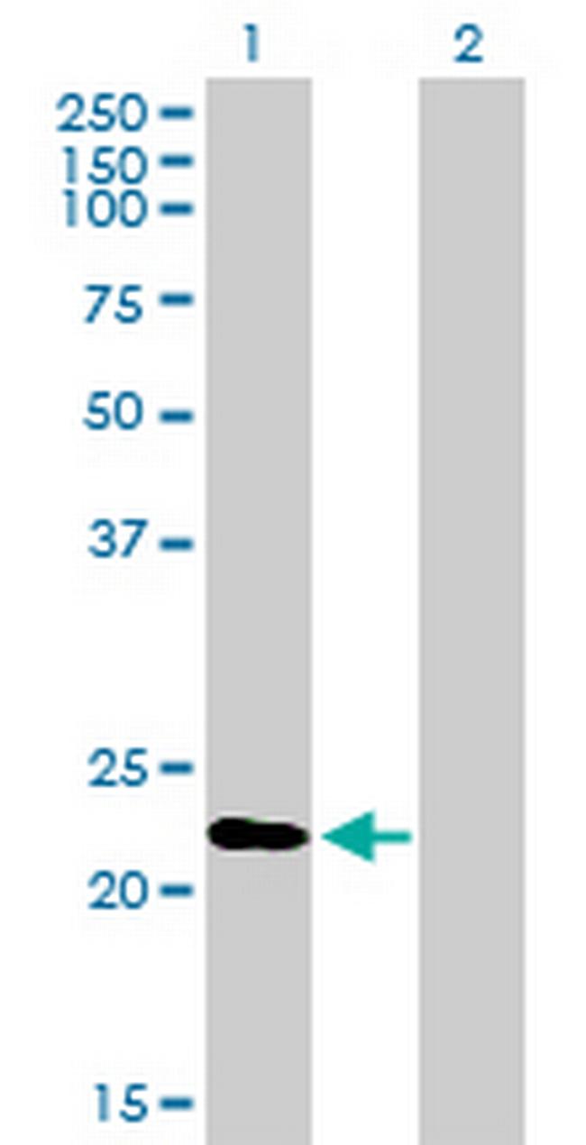 RGS1 Antibody in Western Blot (WB)