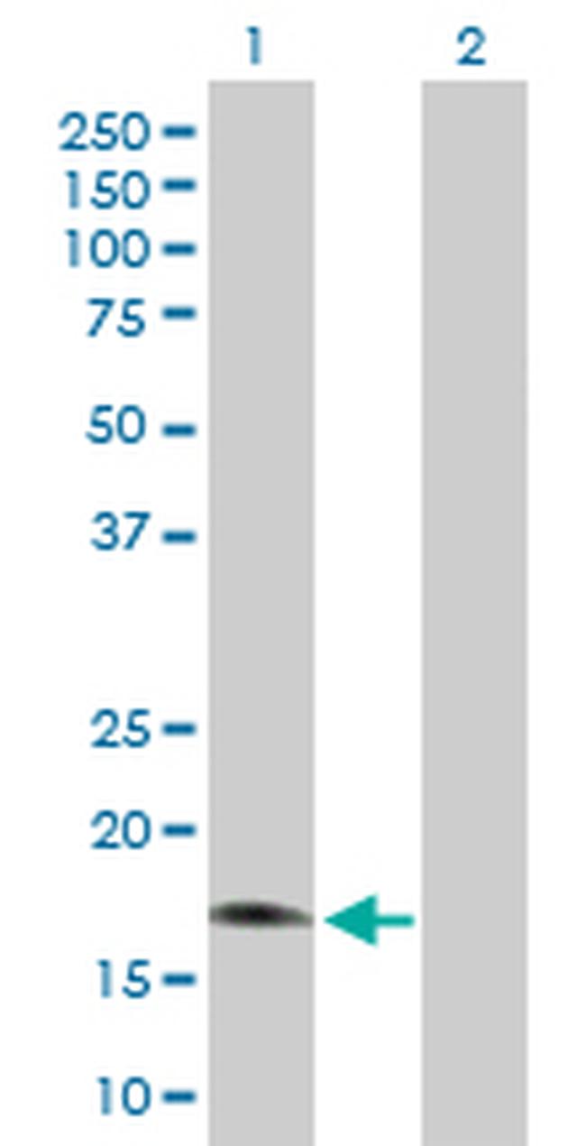 RGS3 Antibody in Western Blot (WB)