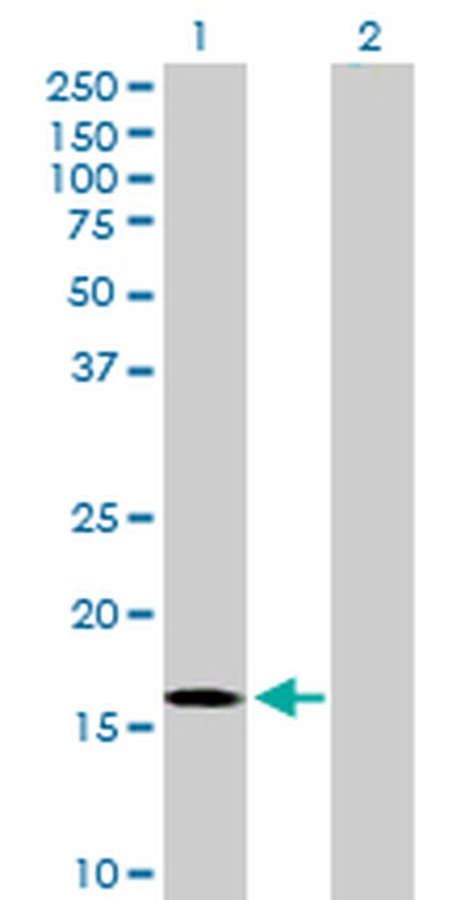 RGS3 Antibody in Western Blot (WB)