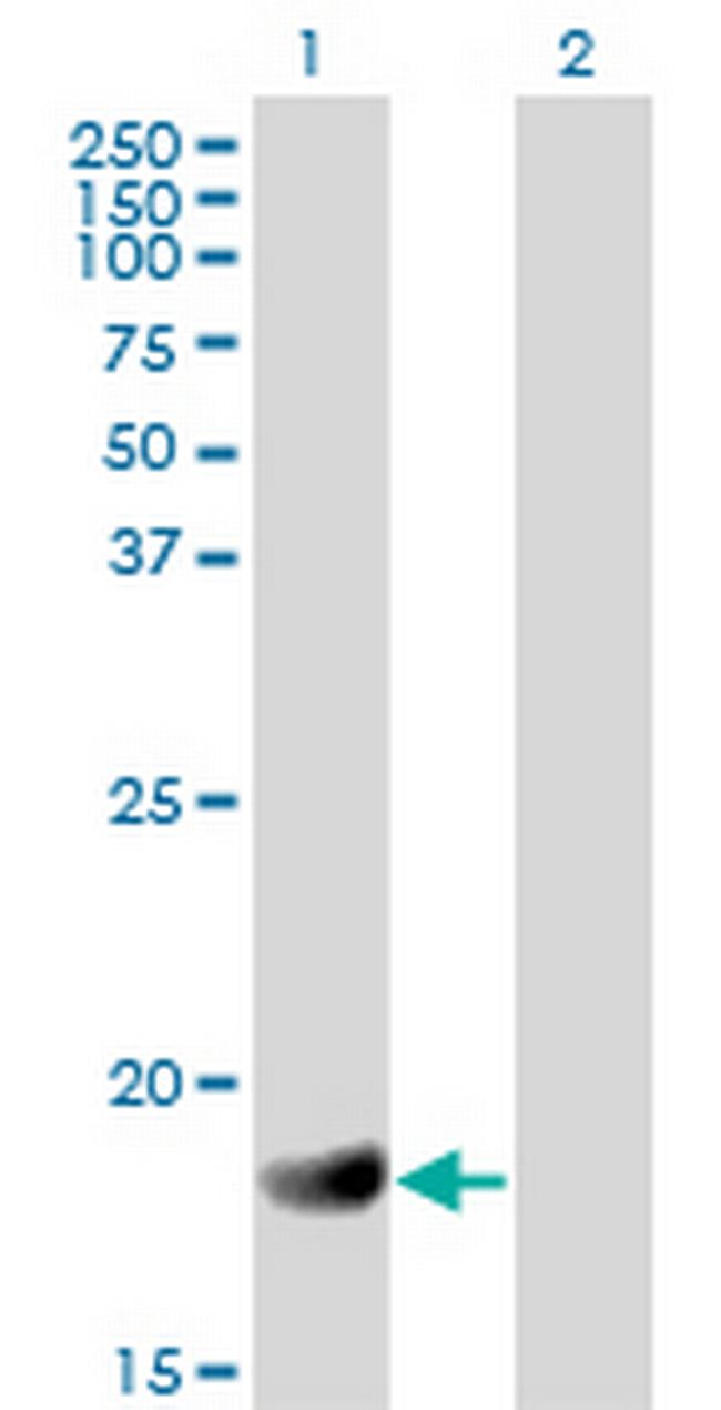 RGS3 Antibody in Western Blot (WB)