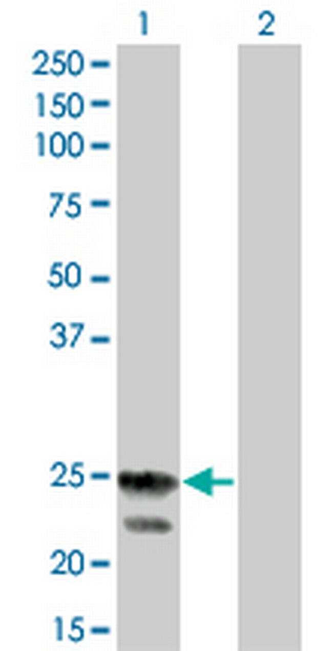 RGS4 Antibody in Western Blot (WB)