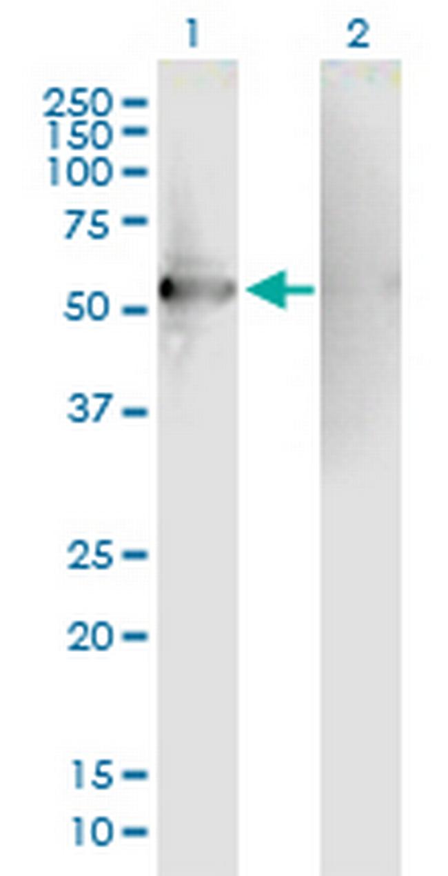 RGS7 Antibody in Western Blot (WB)
