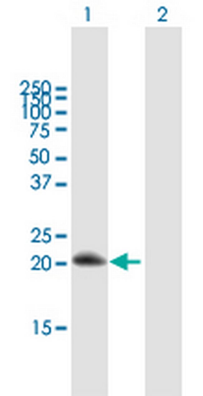 RGS10 Antibody in Western Blot (WB)