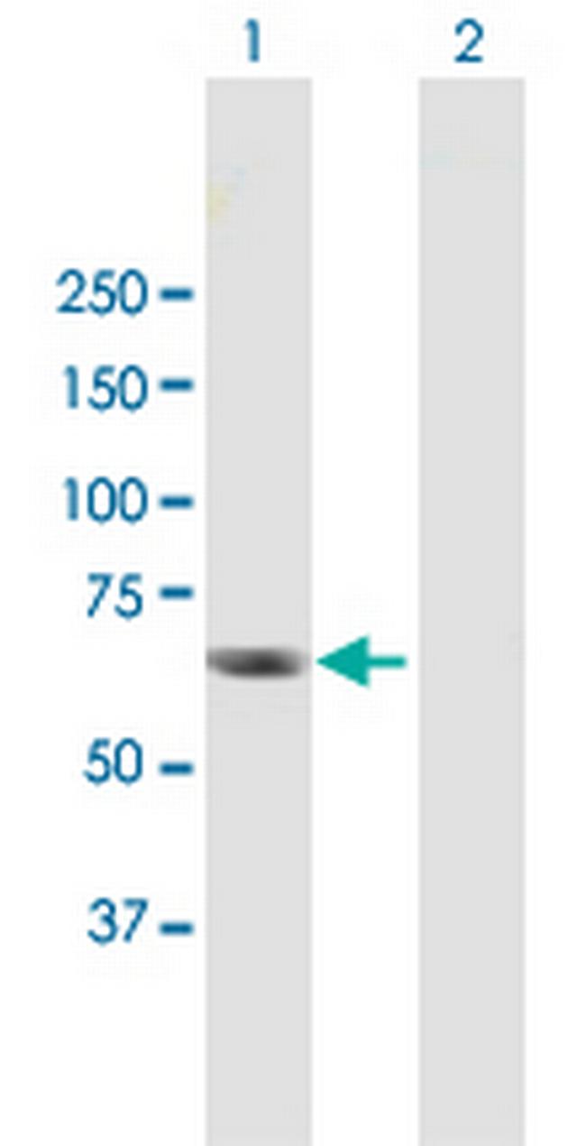 RGS12 Antibody in Western Blot (WB)