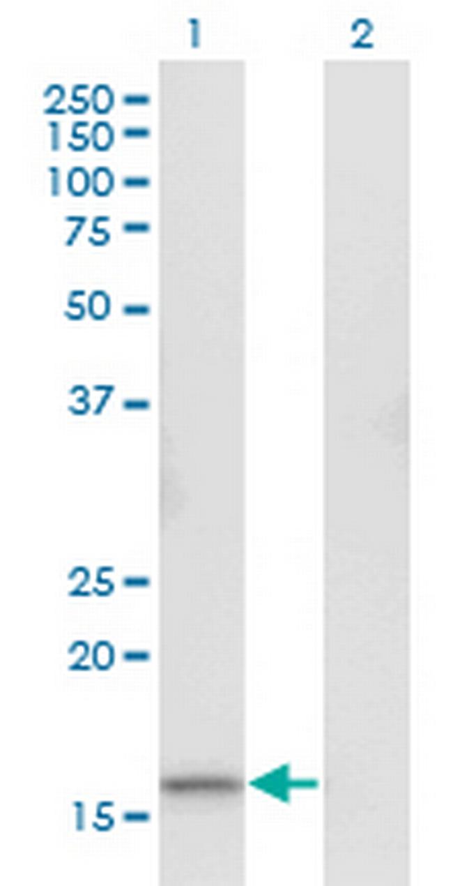 RGS13 Antibody in Western Blot (WB)