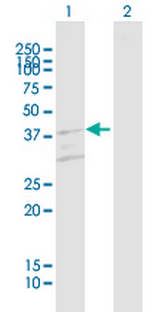 RHD Antibody in Western Blot (WB)